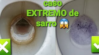 Como limpiar baño lleno de SARRO [upl. by Aillil327]