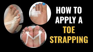 How Do I Do Toe Strapping Dislocated and Fractured Toe [upl. by Tingey]