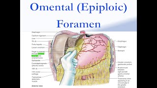 Omental Epiploic Foramen [upl. by Johnsson]