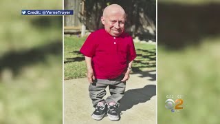 Actor Verne Troyer Dead At 49 [upl. by Cline293]