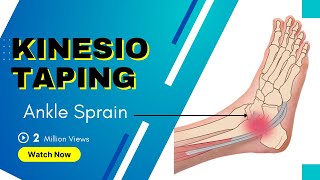 How to treat an Ankle Inversion Sprain  Kinesiology Taping to stabilise ligaments [upl. by Riccardo]