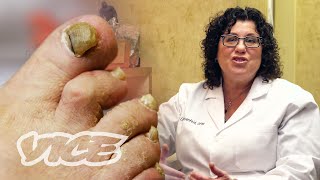 Meet a Toenail Fungus Expert [upl. by Eniroc]