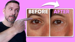 HOW TO MAKE EYE BAGS VANISH IN SECONDS FULL DEMO [upl. by Ilona]