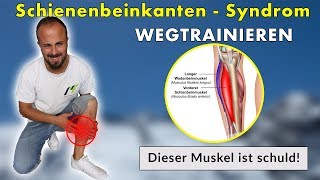 Shin Splints Schienenbeinkantensyndrom  Die 3 Besten Übungen  Ursache amp Lösung [upl. by Simone]