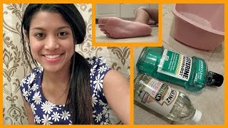 DIY Dry Foot Remedy Review [upl. by Nyrhtac]