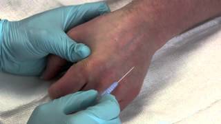 Intravenous Catheter Placement [upl. by Miranda11]