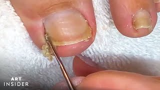 How Toenails Are Professionally Cleaned [upl. by Ahsienaj133]