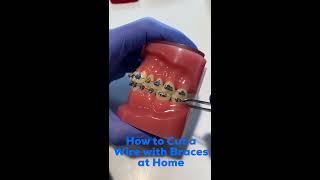 How to Cut an Orthodontic Wire at Home  David Ross Orthodontics [upl. by Ahrat]