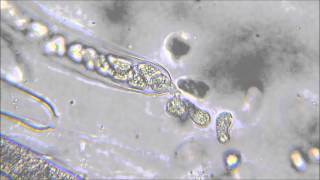 Oomycota zoospores being released from sporangia [upl. by Siusan550]