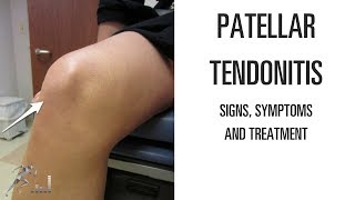 Patellar tendonitis Signs symptoms and remedies for this difficult knee problem [upl. by Scarrow344]