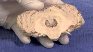 The Cerebellum Neuroanatomy Video Lab  Brain Dissections [upl. by Nahseez]