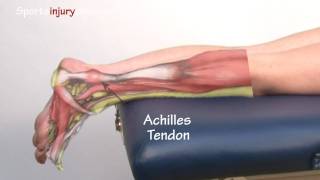 Achilles Tendonitis  Tendinopathy  Explained in 90 Seconds [upl. by Gans]