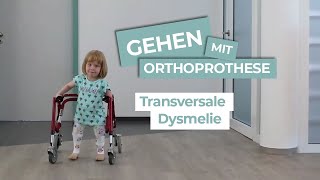 Transversale Dysmelie  Gehen mit Orthoprothesen [upl. by Odnaloy]