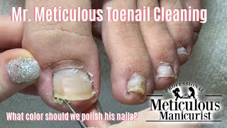 Shortn Sweet  Mr Meticulous Satisfying Impacted Toenail Cleaning [upl. by Bloxberg110]